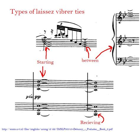 laissez vibrer tie.